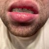 14k Gold Finish Silver Real Baguette Grills for Teeth