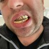 14K Yellow Gold Top & Bottom Grills for Teeth