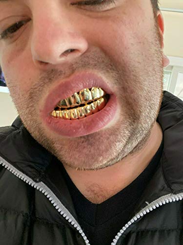 14K Yellow Gold Top & Bottom Grills for Teeth