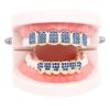 18K Gold with Red Blue Pink Diamond Top and Bottom Grills