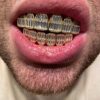 14k Gold Finish Silver Real Baguette Grills for Teeth