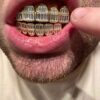 14k Gold Finish Silver Real Baguette Grills for Teeth