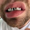 Harlembling Sterling Silver Custom Fit Grillz – Shine with Style and Confidence