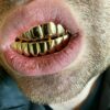 14K Yellow Gold Top & Bottom Grills for Teeth