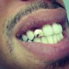14K Yellow Gold Top & Bottom Grills for Teeth