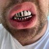 Harlembling Sterling Silver Custom Fit Grillz – Shine with Style and Confidence