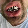 Silver op & Bottom Grills for Teeth Harlembling